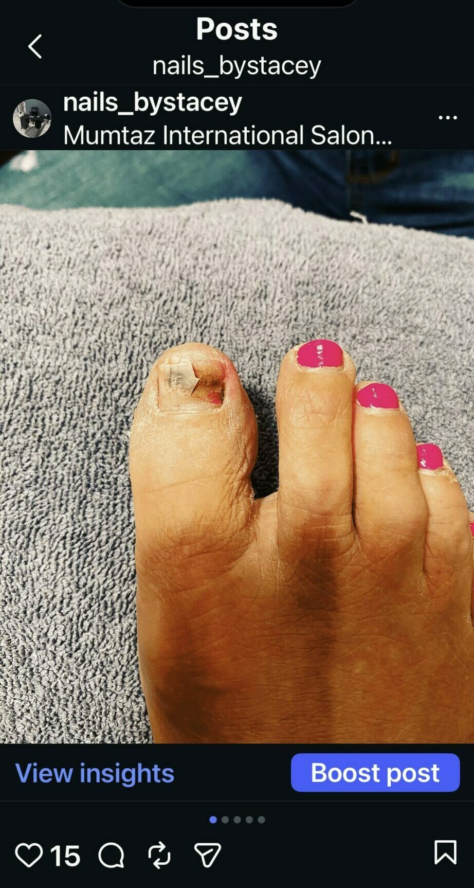 Close-up of a person's foot with painted toenails resting on a surface, with a background of a car and sky.