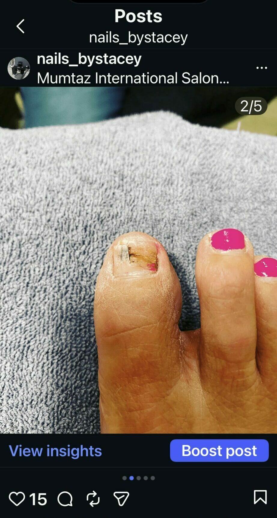 Close-up of a person's toes with one toenail painted pink and the other toenail damaged, on a gray surface.