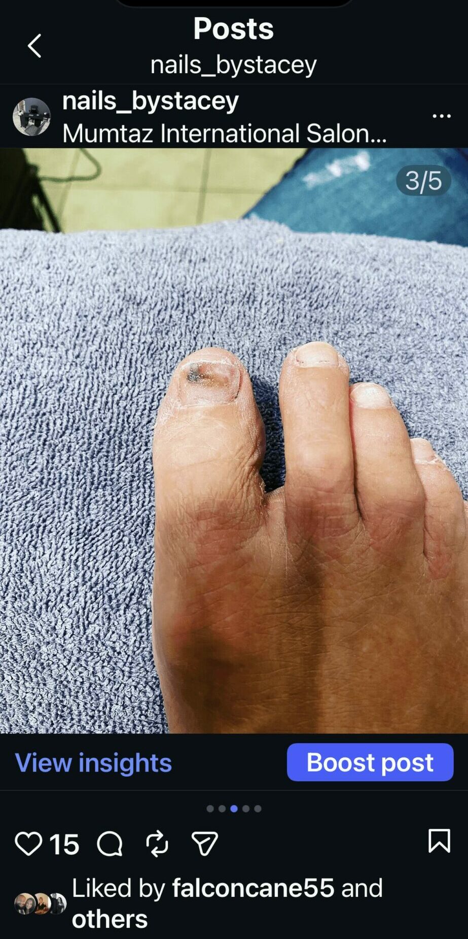 Close-up of a person's hand resting on a gray fabric surface, with a blue cloth in the background.
